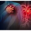 Research Reveals that the Most Frequent Side Effect of Atrial Fibrillation is Heart Failure Rather than Stroke