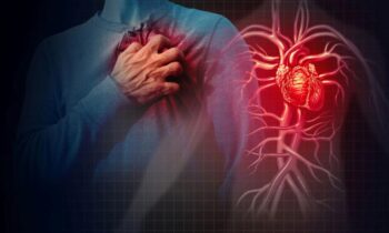 Research Reveals that the Most Frequent Side Effect of Atrial Fibrillation is Heart Failure Rather than Stroke